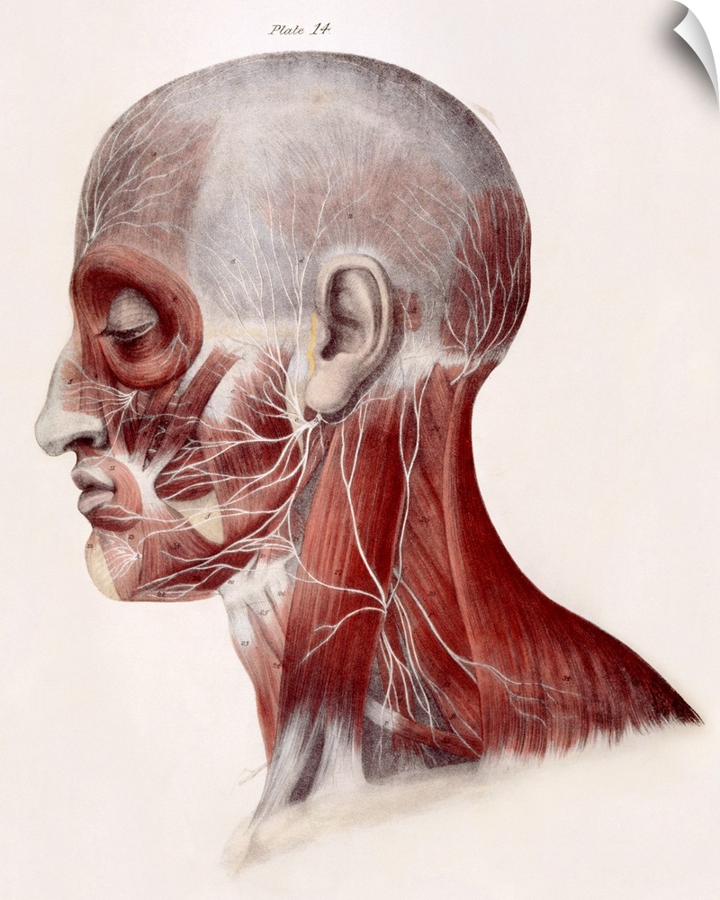 Facial nerves. Historical anatomical artwork of a side view of a dissected human head showing the nerves (white) and muscl...