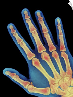 Healthy adult hand, X-ray
