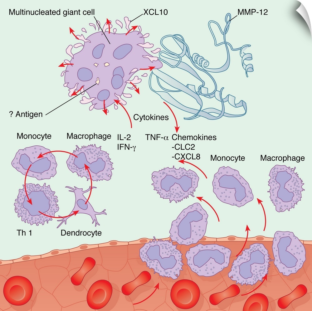 Human immune response. Computer artwork showing the interactions of the various white blood cells (purple) involved during...