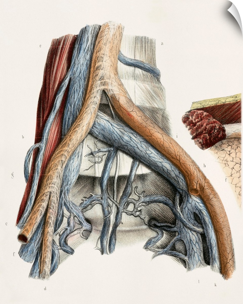 Iliac blood vessel nerves. This anatomical artwork is figure 3, plate 96 from volume 3 (1844) of 'Traite complet de l'anat...