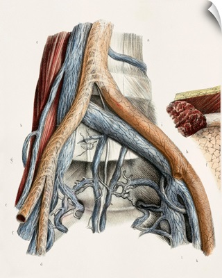 Iliac blood vessel nerves, 1844 artwork