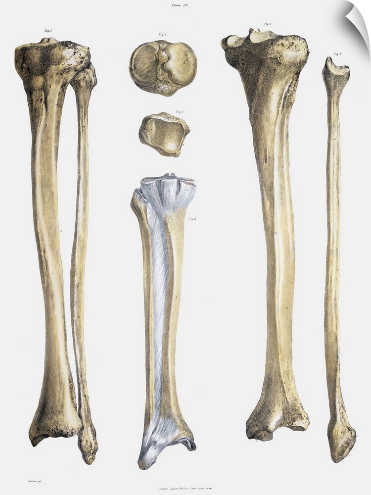 Lower leg bones and ligaments. Historical anatomical artwork of lower leg bones (yellow) and ligaments (pale blue). Ligame...