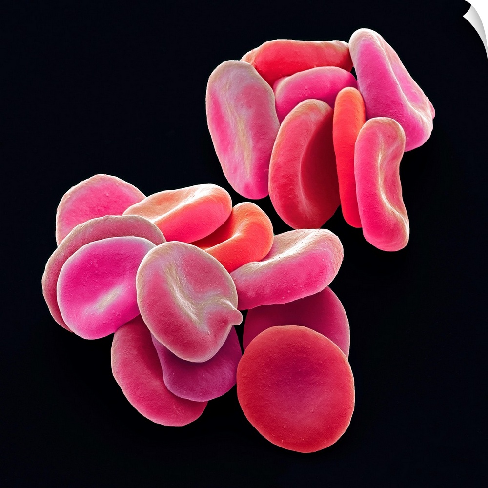 Red blood cells. Coloured scanning electron micrograph (SEM) of red blood cells (RBCs, erythrocytes). Red blood cells are ...