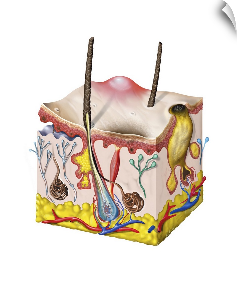 Skin anatomy. Block cutaway artwork showing the anatomy of human skin, including two blocked pores (pimple, red; and black...