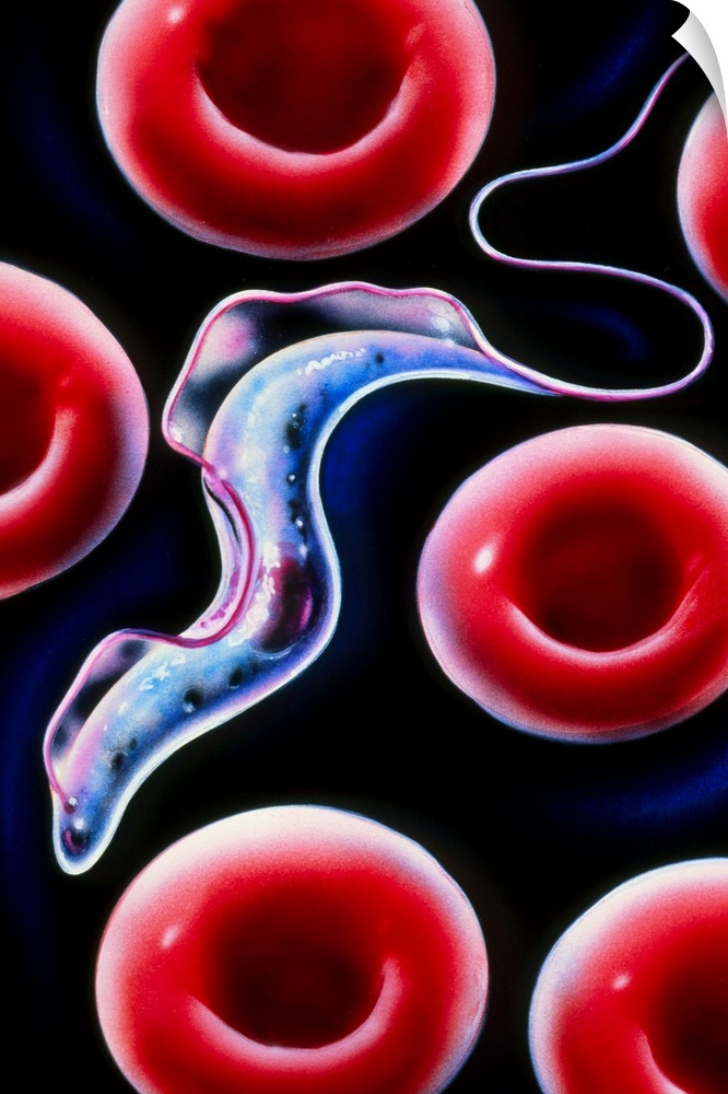 Sleeping sickness. Artwork of a trypanosome (Trypanosoma brucei) moving past human red blood cells in the blood. This prot...