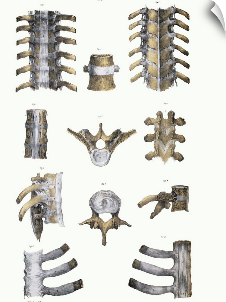 Spinal bones and ligaments. Historical anatomical artwork of thoracic (upper) spinal bones (yellow, vertebrae) and ligamen...