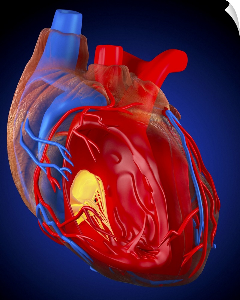 Structure of a human heart. Computer artwork of a heart with the right ventricle (second chamber) removed, showing the ins...