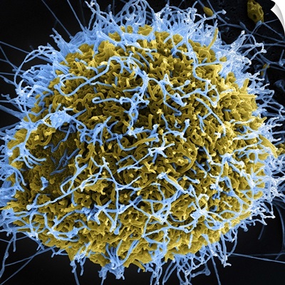 Colorized scanning electron micrograph of filamentous Ebola virus particles
