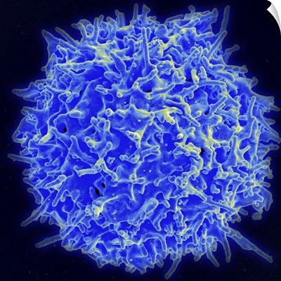 Scanning electron micrograph of a human T cell