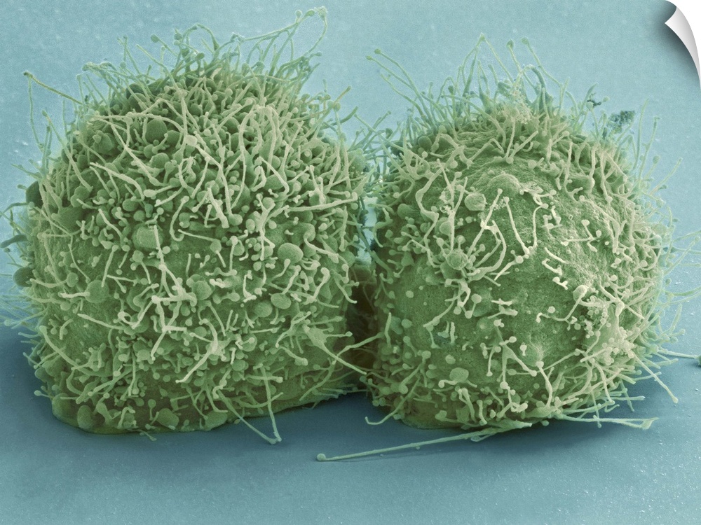 Scanning electron micrograph of just-divided HeLa cells. Zeiss Merlin HR-SEM.