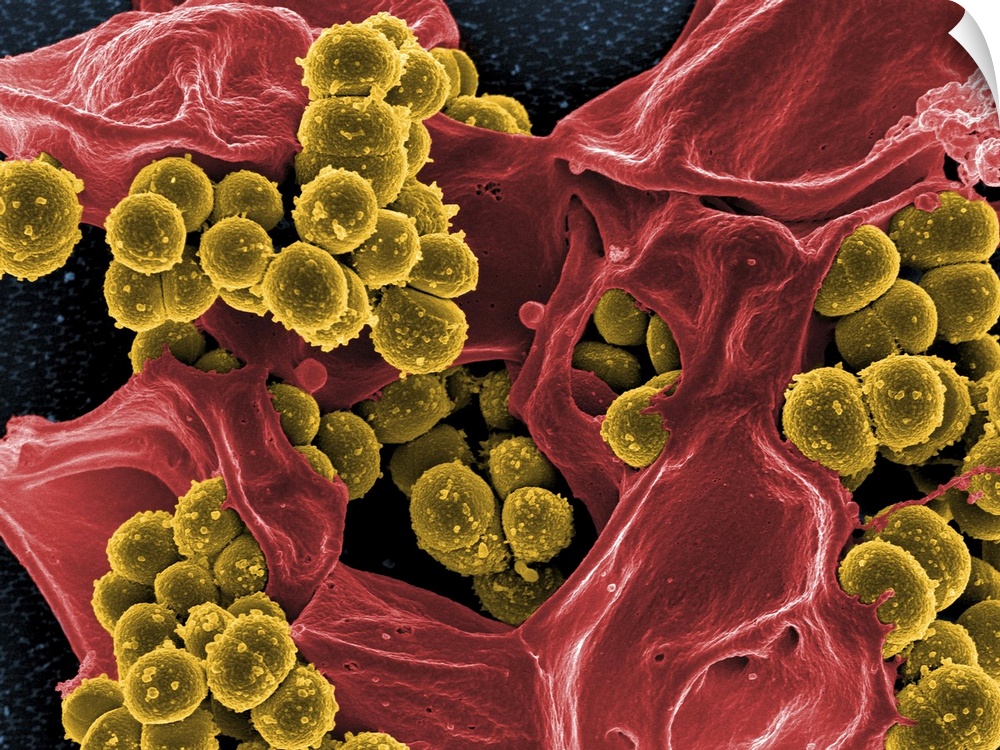 Scanning electron micrograph of methicillin-resistant Staphylococcus aureus and a dead human neutrophil..