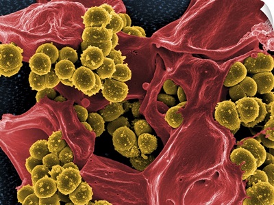 Scanning electron micrograph of Staphylococcus and a dead human neutrophil