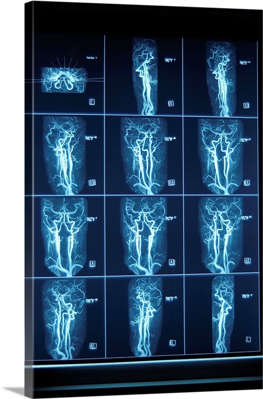 Cardiovascular scan | Great Big Canvas