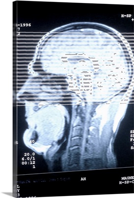 CAT scan of human head