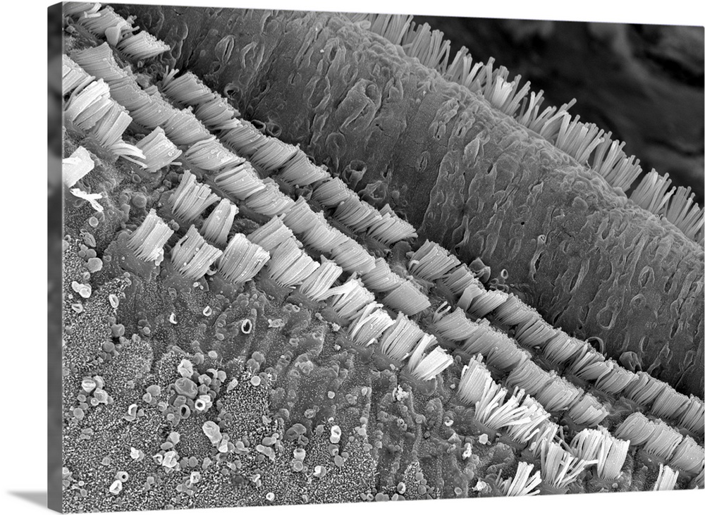 Rows of tiny hair cells (stereocilia) line the cochlea membrane and detect movements related to hearing. these are transdu...