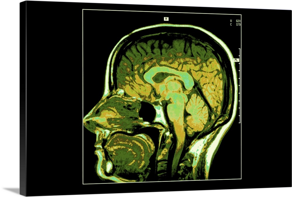Cross section image of human head