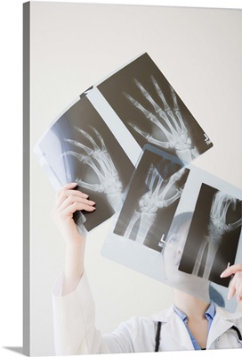 Doctor looking at x-rays of hand bones