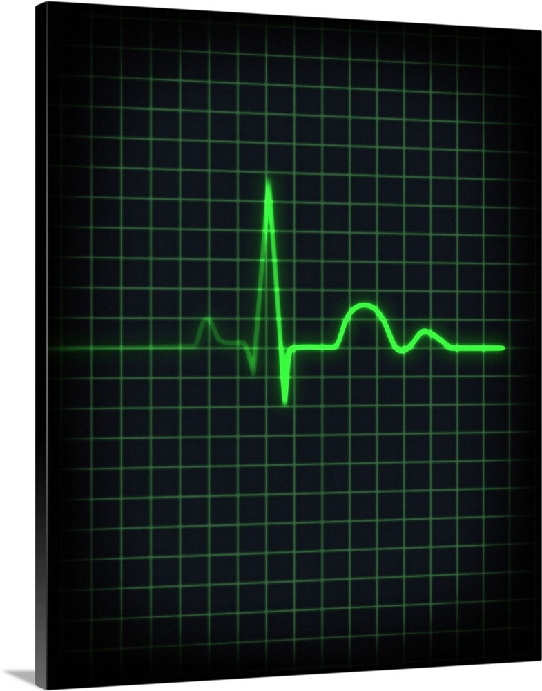 Electrocardiogram of human heartbeat, closeup Wall Art, Canvas Prints