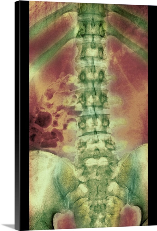 Normal spine, X-ray | Great Big Canvas