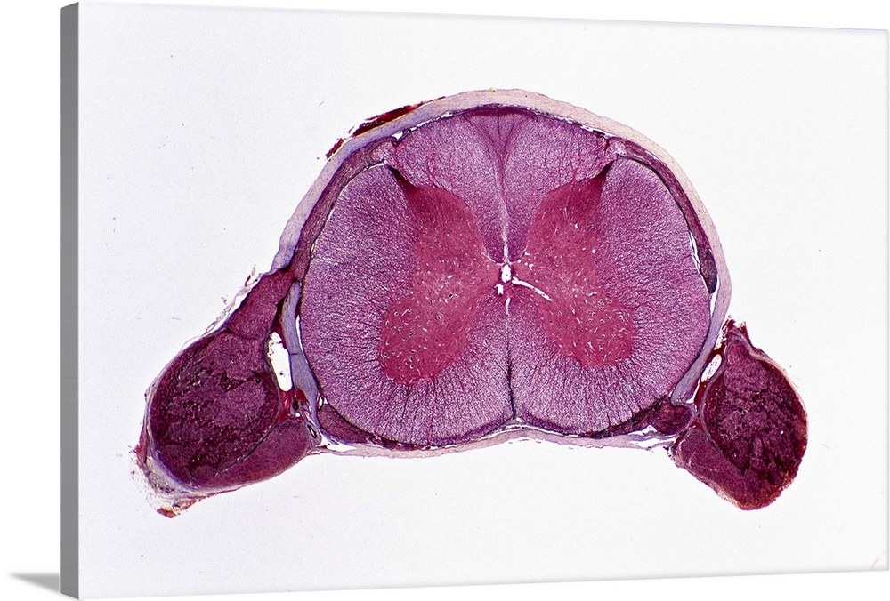 SPINAL CORD. CROSS SECTION, 2.5X. Shows: gray matter, white matter, dorsal root ganglia, dorsal and ventral roots, central...