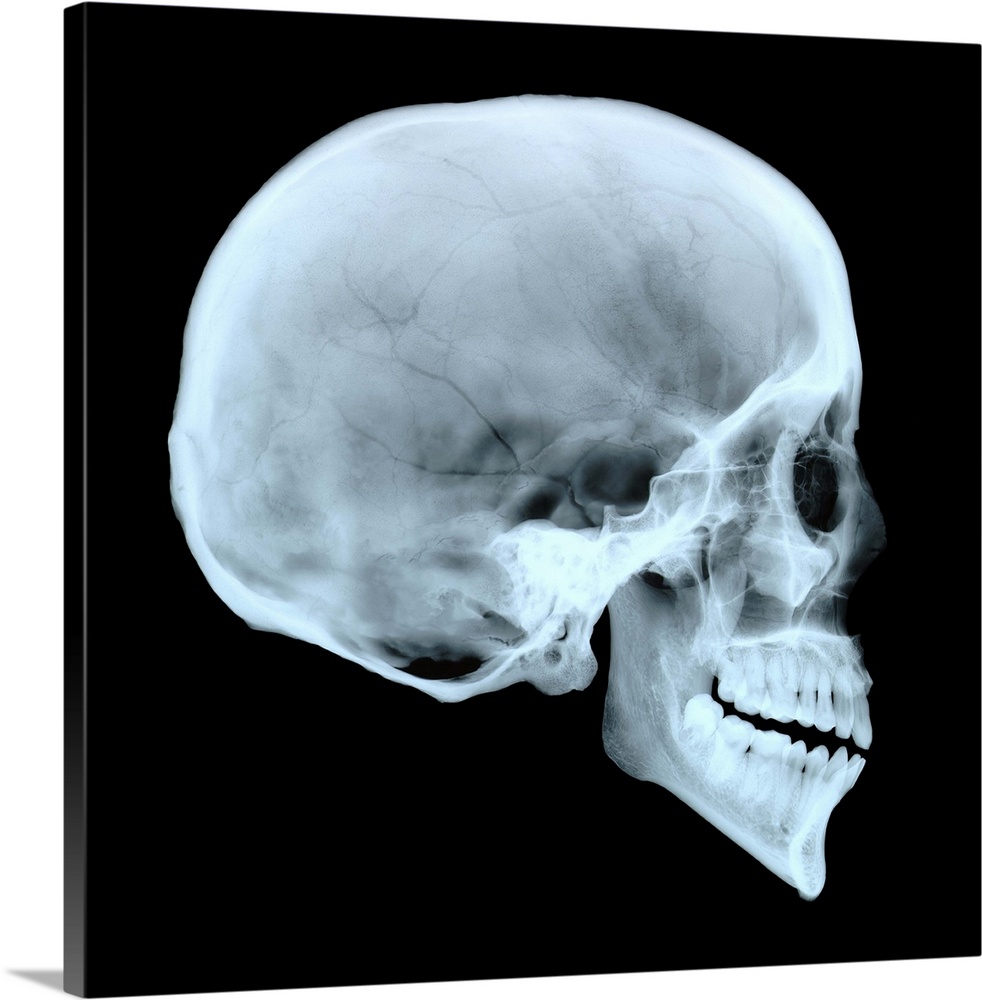Adult human skull. Side view X-ray showing the cranium, eye socket, nasal area and teeth. For an X-ray of a baby's skull s...