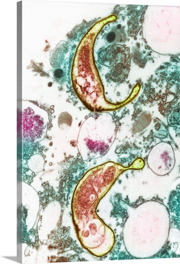 AIDS pneumonia infection. Coloured transmission electron micrograph (TEM) of a section through Pneumocystis carinii protoz...