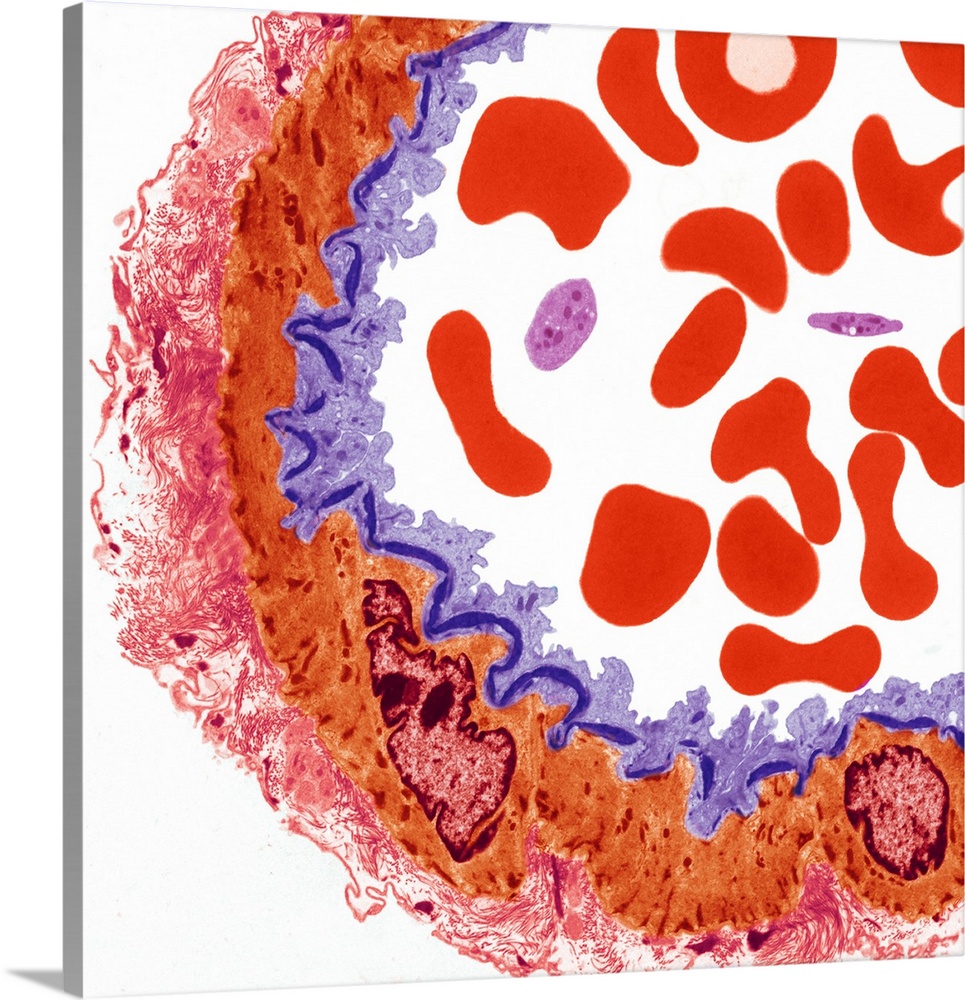 Artery. Coloured transmission electron micrograph (TEM) of a transverse section through part of an artery. Red blood cells...