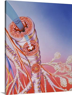 Artwork of bronchodilator action in asthma