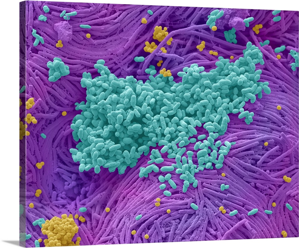 Coloured scanning electron micrograph (SEM) of bacteria cultured from a mobile phone. Tests have revealed the average hand...