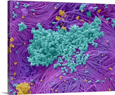 Bacteria Found On Mobile Phone, SEM