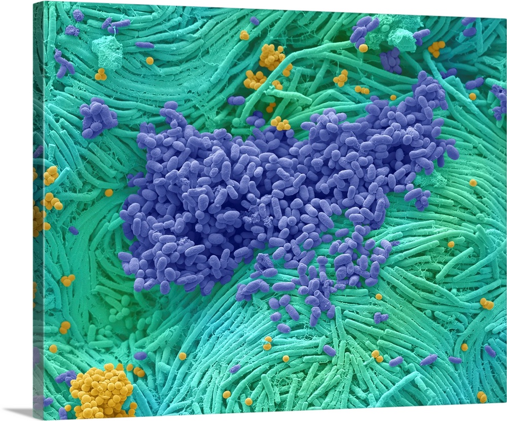 Coloured scanning electron micrograph (SEM) of bacteria cultured from a mobile phone. Tests have revealed the average hand...