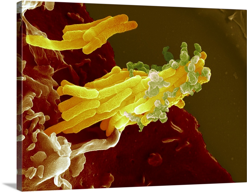 Bacteria infecting a macrophage. Coloured scanning electron micrograph (SEM) of Mycobacterium tuberculosis bacteria (yello...