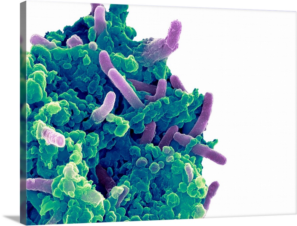 Bacteria infecting a macrophage. Coloured scanning electron micrograph (SEM) of Mycobacterium tuberculosis bacteria (purpl...