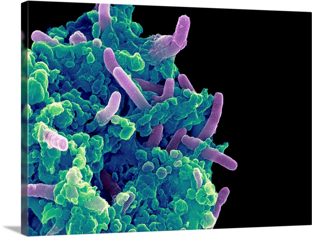 Bacteria infecting a macrophage. Coloured scanning electron micrograph (SEM) of Mycobacterium tuberculosis bacteria (purpl...