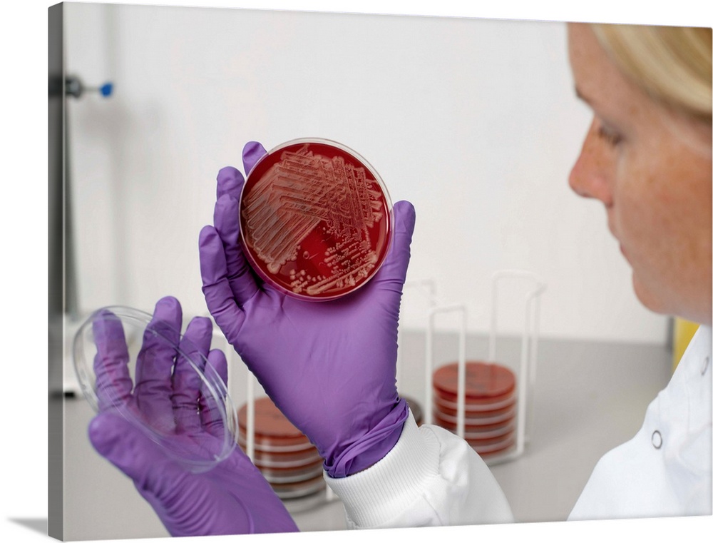 MODEL RELEASED. Bacterial contamination tests. Laboratory worker examining a petri dish that was used to culture human tis...