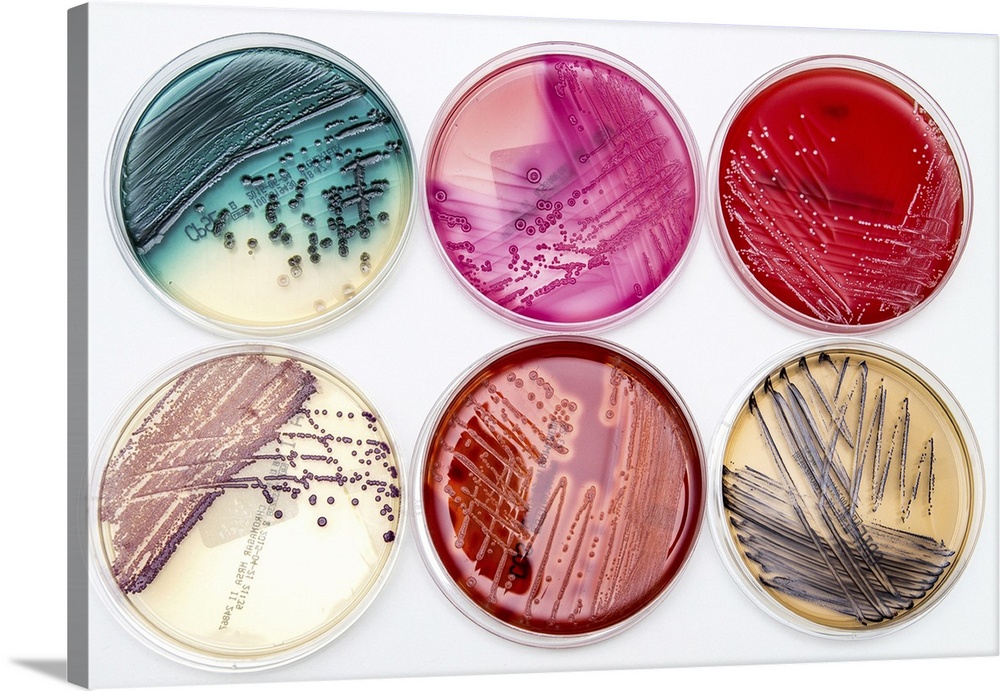 Bacterial growth on culture media. Colourful selection of the variety of differential and selective culture media used in ...