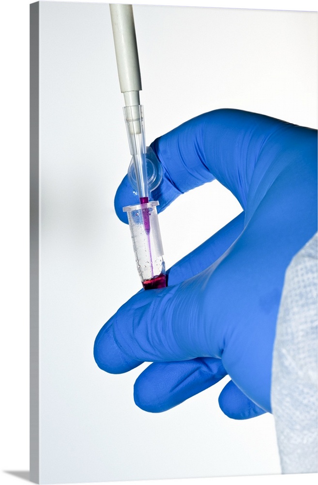 Biochemical research. Close-up of a pipette being used to fill a sample well.