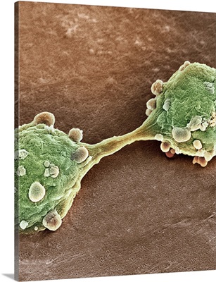 Bladder cancer cells dividing, SEM