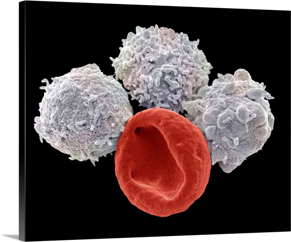 Blood cells. Coloured scanning electron micrograph (SEM) of a red blood cell (erythrocyte, red) and white blood cells (leu...