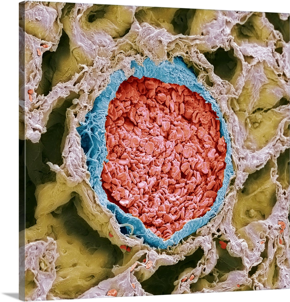 Blood-filled pulmonary arteriole. Coloured scanning electron micrograph (SEM) of a section through an arteriole (blue) in ...