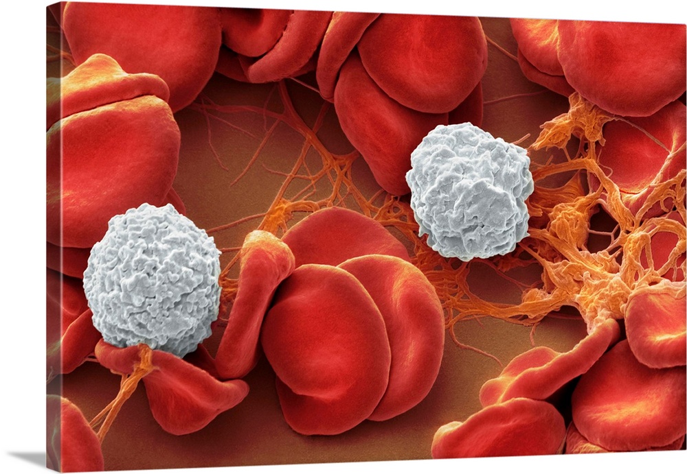 Human blood cells, Coloured scanning electron micrograph (SEM) of a variety of blood cells from the site of an early skin ...