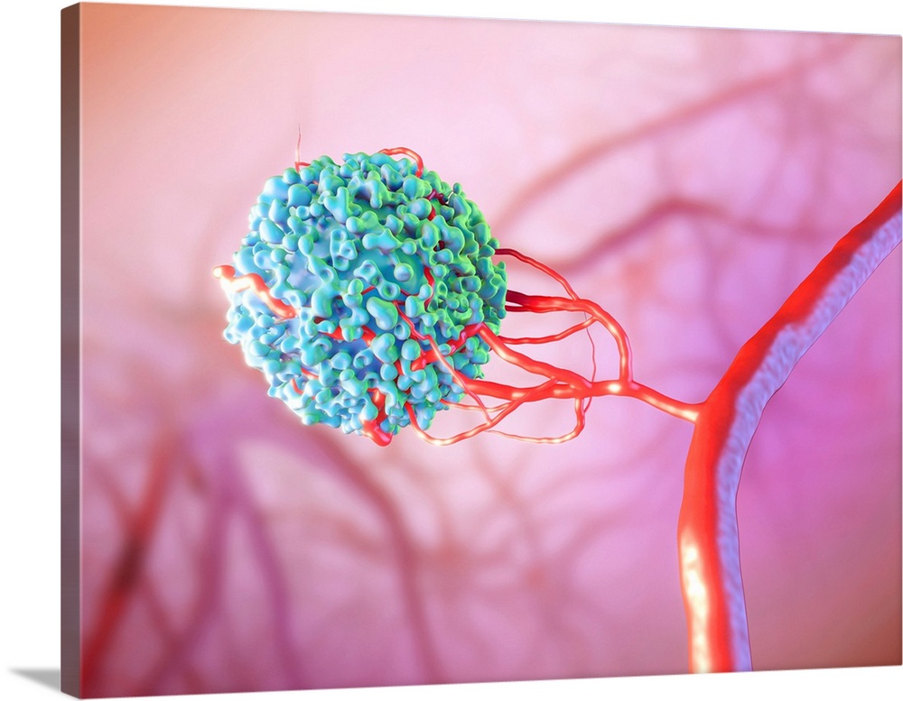 Blood vessel formation. Illustration showing a malignant (cancerous) cell (blue) promoting the formation of new blood vess...
