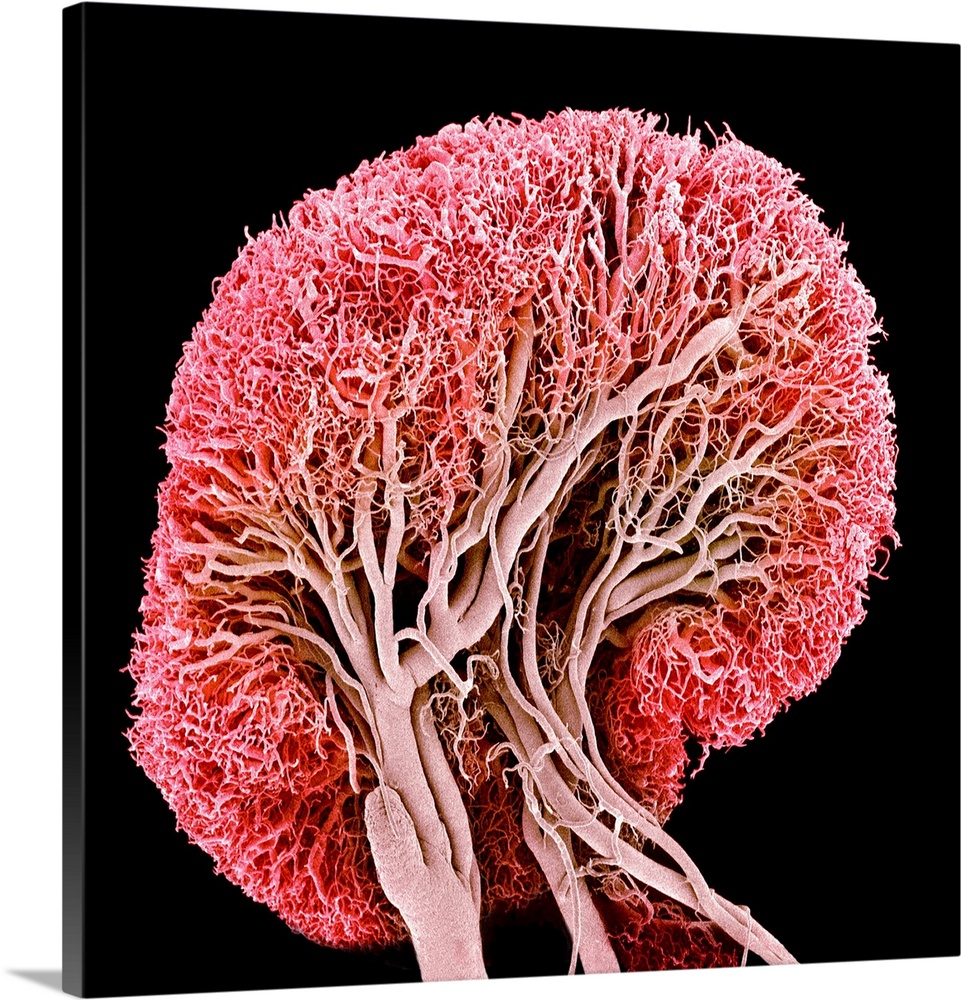 Blood vessels. Coloured scanning electron micrograph (SEM) of a resin cast of blood vessels in a lymph node. This network ...