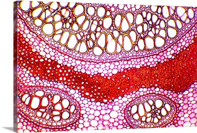 Bracken rhizome, light micrograph