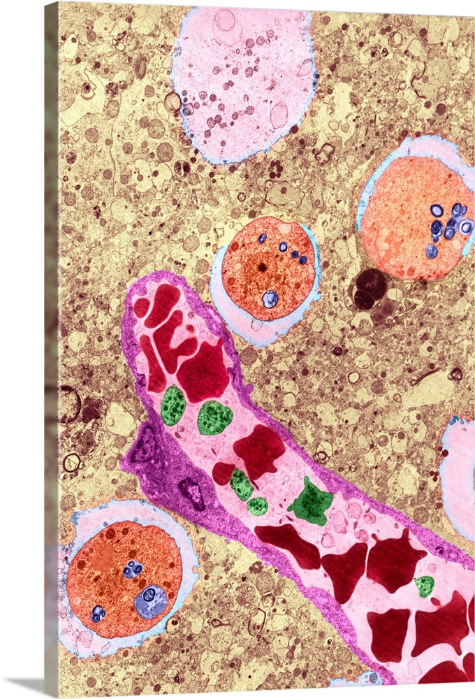 Brain inflammation (meningoencephalitis). Coloured transmission electron micrograph (TEM) of several Naegleria fowleri pro...