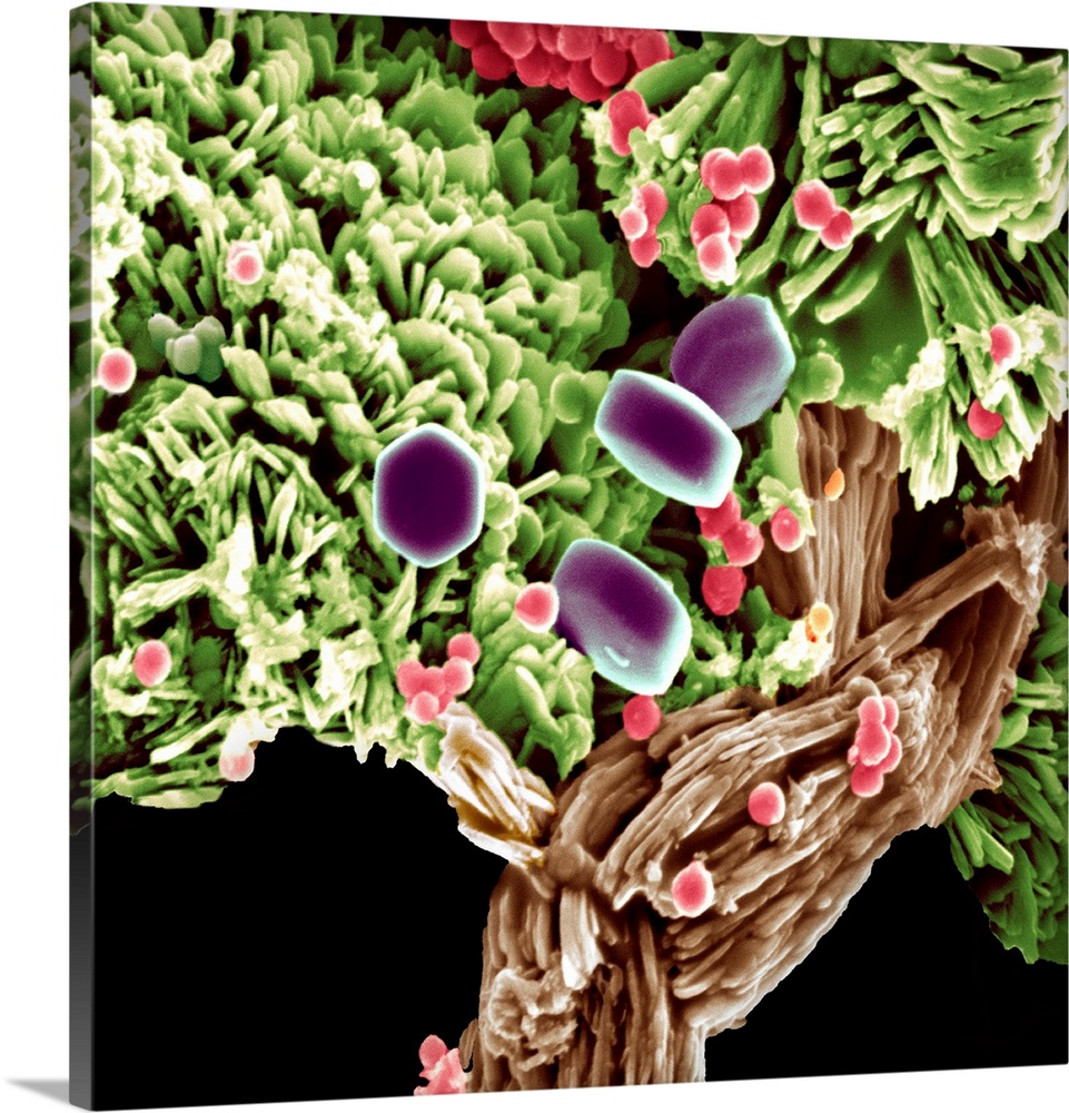 Coloured scanning electron micrograph (SEM) of calcium phosphate platelets that have been grown in a mineralising solution...