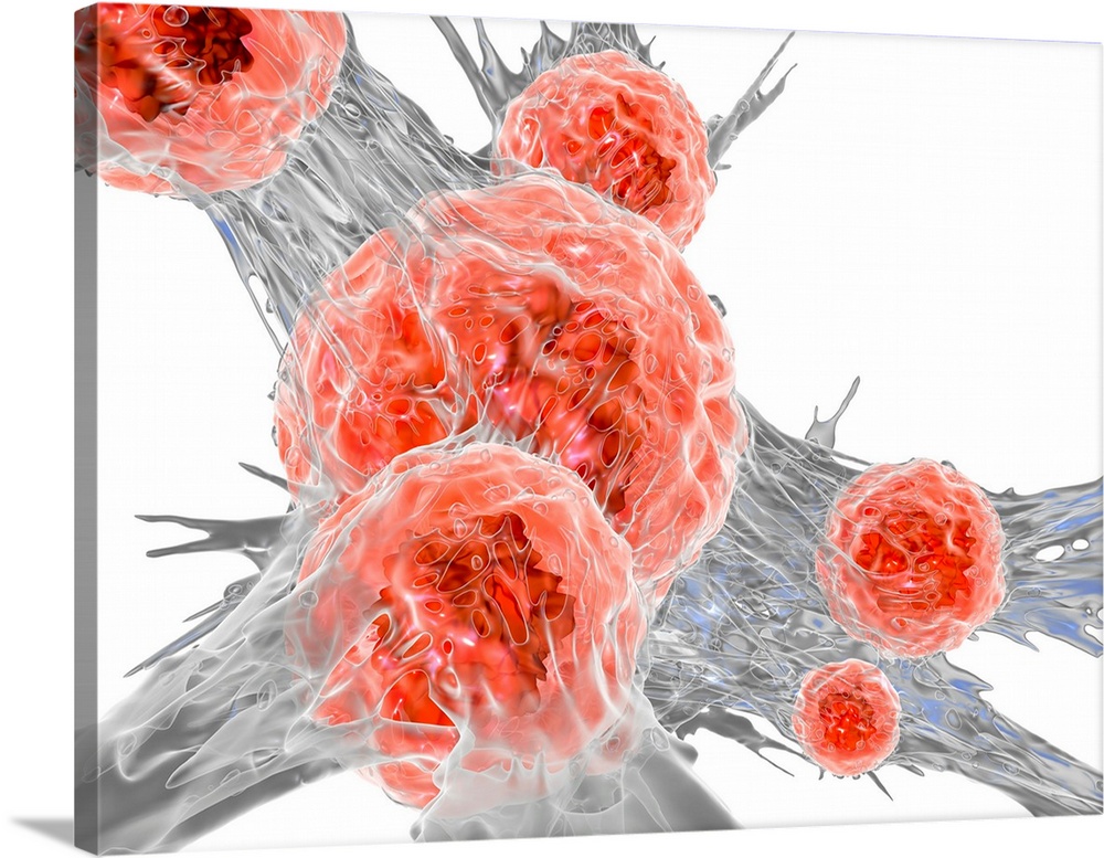 Cancer cell. Computer illustration of cancer cells, showing the cytoplasm (grey) and the cells with their nuclei (red).