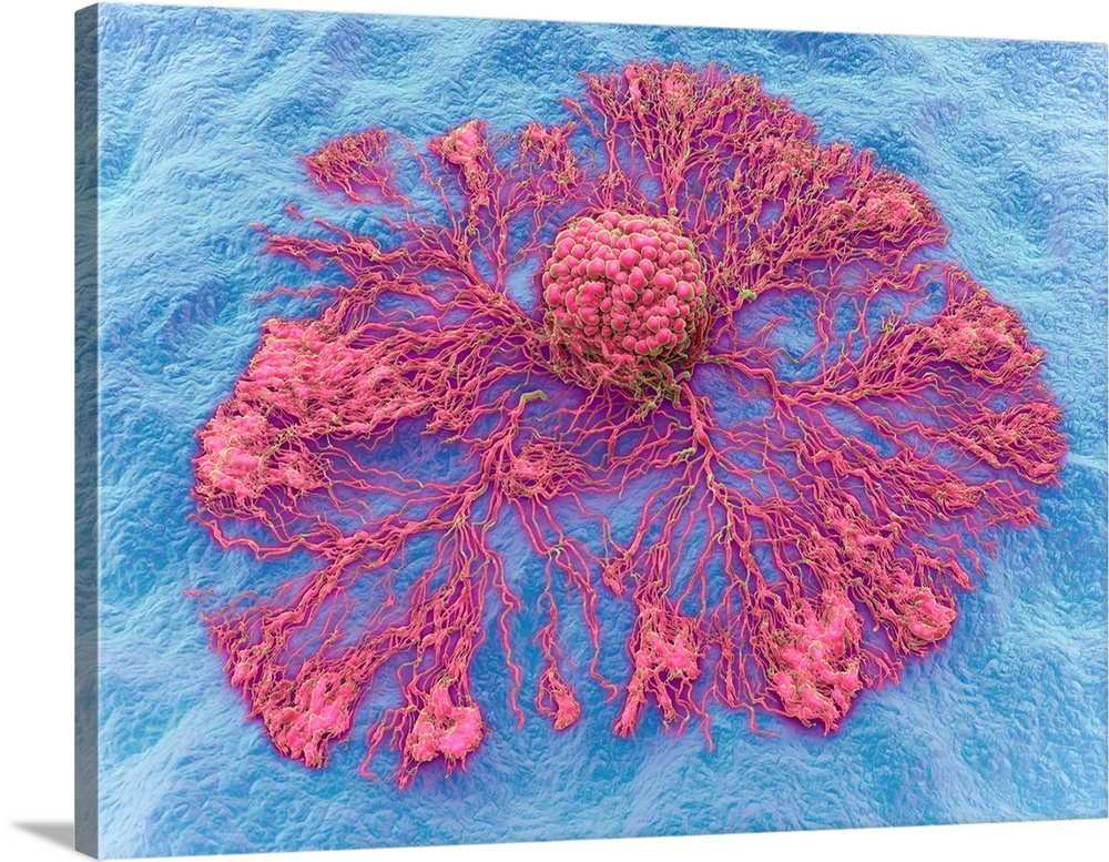 Cancer cell spreading. Three-dimensional computer illustration of a cancer cell spreading.