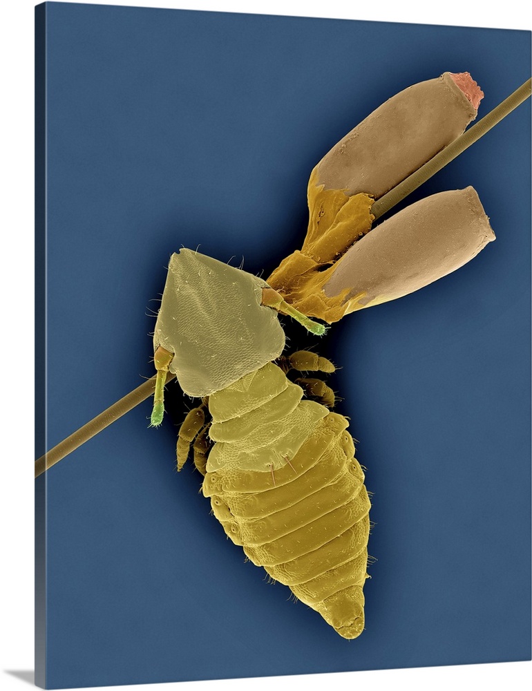 Coloured scanning electron micrograph (SEM) of Cat biting louse and egg cases (Felicola subrostratus). The cat biting lous...