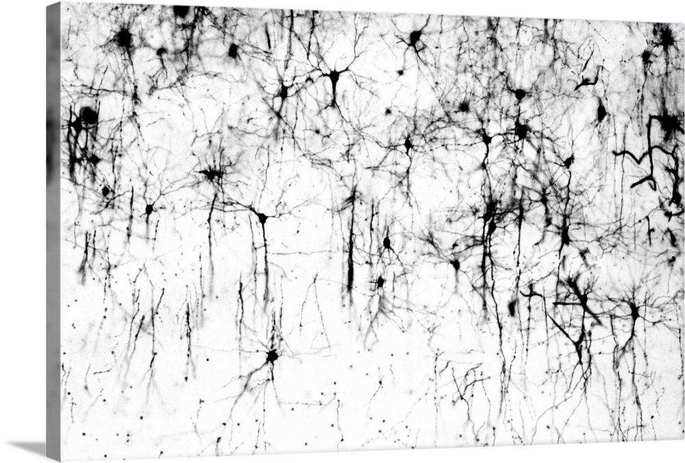 Cerebral cortex nerve cells. Light micrograph of a section through neurones (nerve cells, black) in the cerebral cortex of...